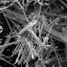 fibras del mineral de asbestos, vistas con microscopio electrónico.